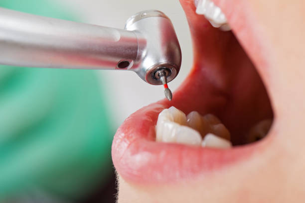 Dentist for Dental Trauma in WY
